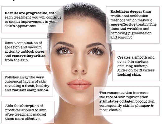 microdermabrasion benefits